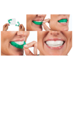 Opalescence GO 6% Mint Patient Kit Ultradent - Image 2